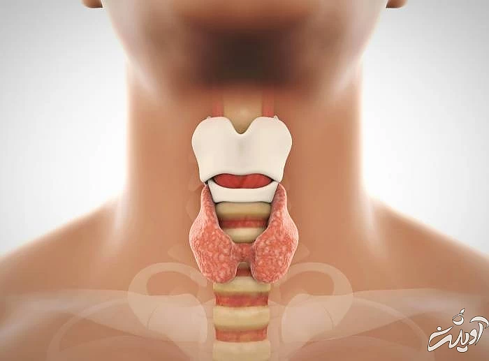 تیروئید کم کار از دلایل خواب رفتن دست و پا هیپوتیروئید